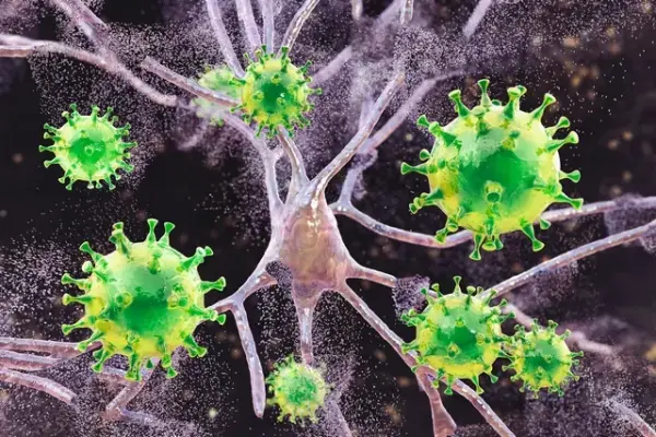 Bệnh sởi đang gây sưng não ở trẻ em tại Nam Carolina.