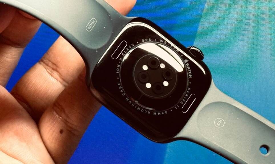 Các nút bên hông trên Apple Watch Series 11.