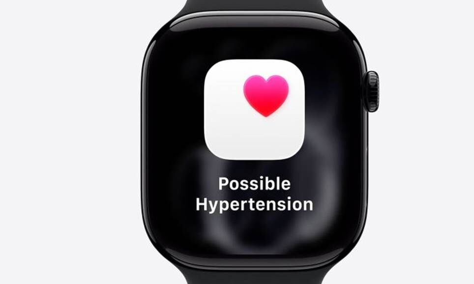 Đồng hồ Apple Series 11.