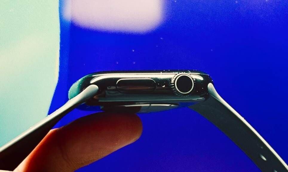 Các nút bên hông trên Apple Watch Series 11.