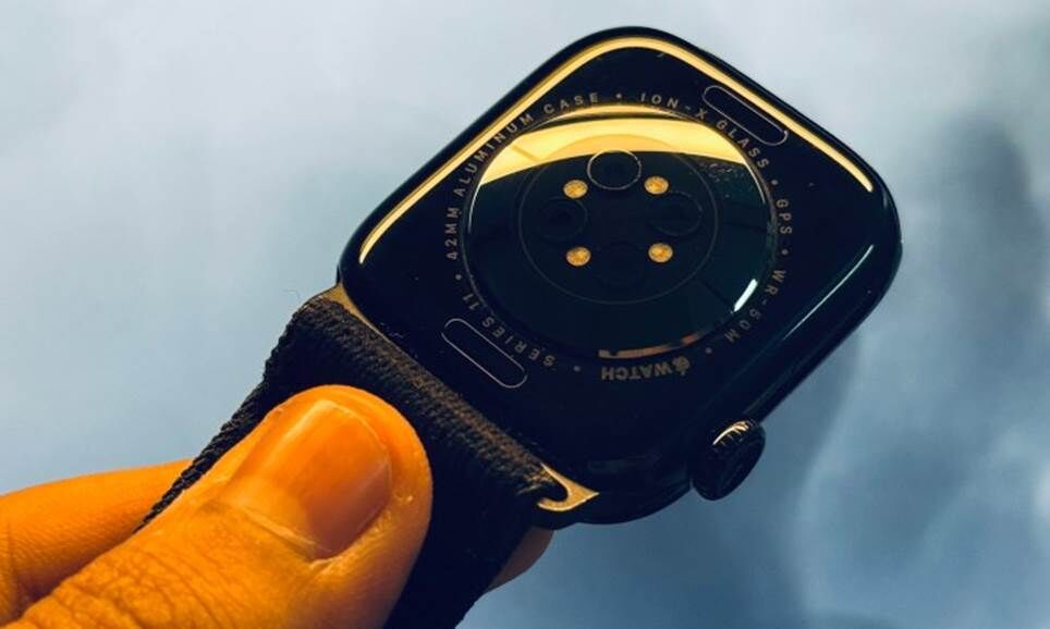 Trung tâm cảm biến trên Apple Watch Series 11.