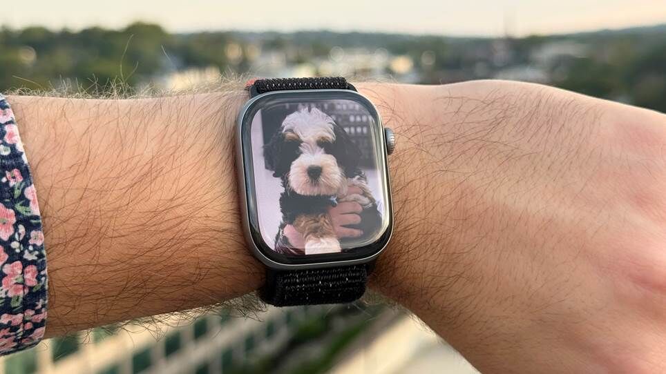 ĐÁNH GIÁ Apple Watch Series 11